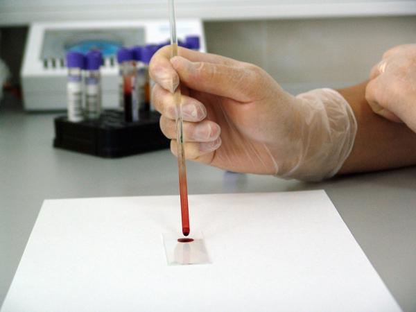 Testy alergii na psa - badania krwi
